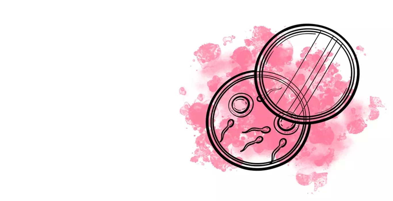 Laser Assisted Hatching (LAH) Treatment in IVF Indira IVF